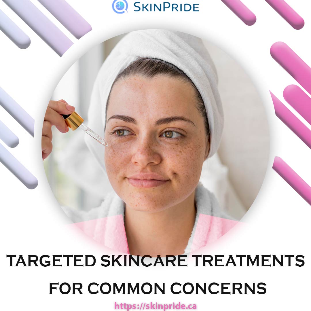 Targeted Skincare Treatments for Common Concerns-SkinPride