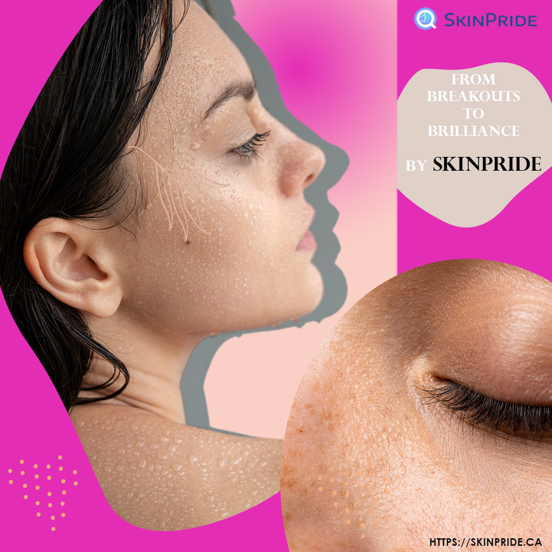 Close-up of radiant, clear skin achieved through SkinPride's skincare solutions