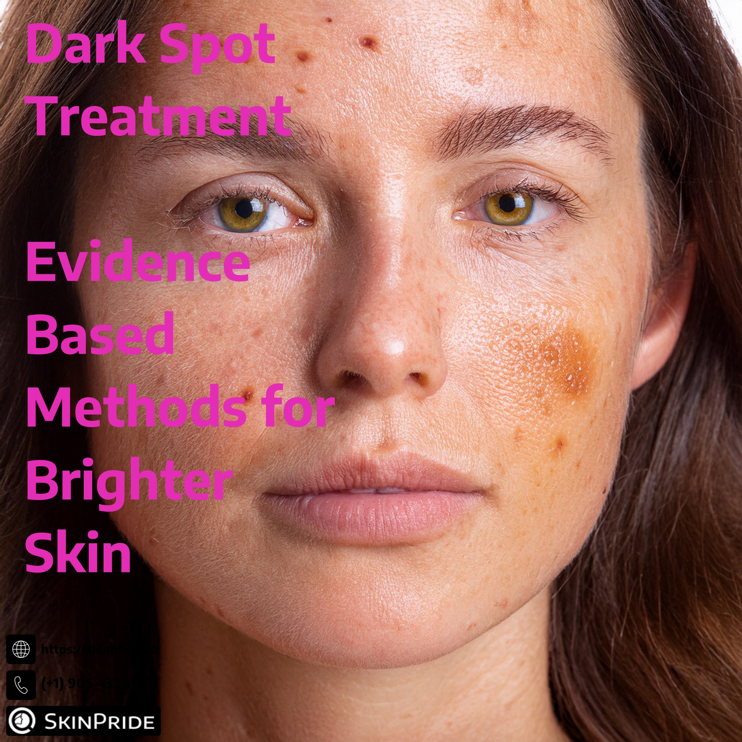 Dark Spot Treatment: Evidence-Based Methods for Brighter Skin