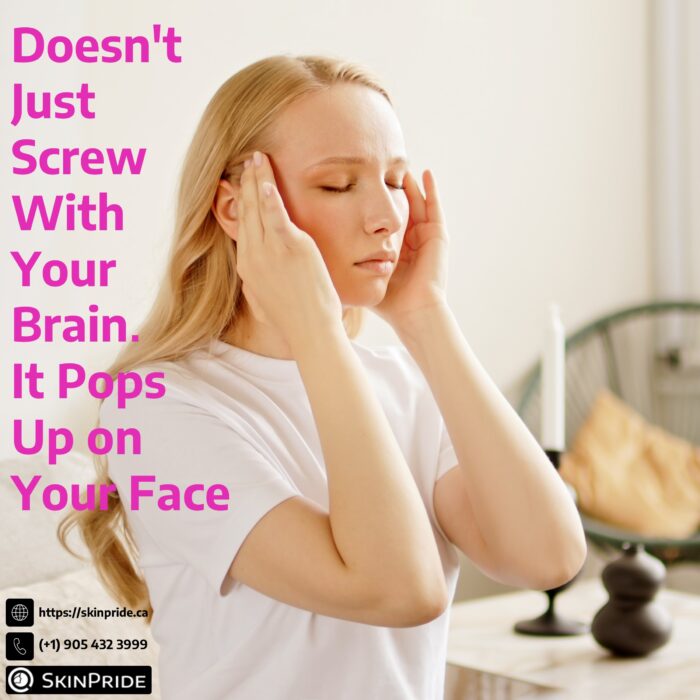 A girl with a stressed look on her face and her hands on the sides of her head